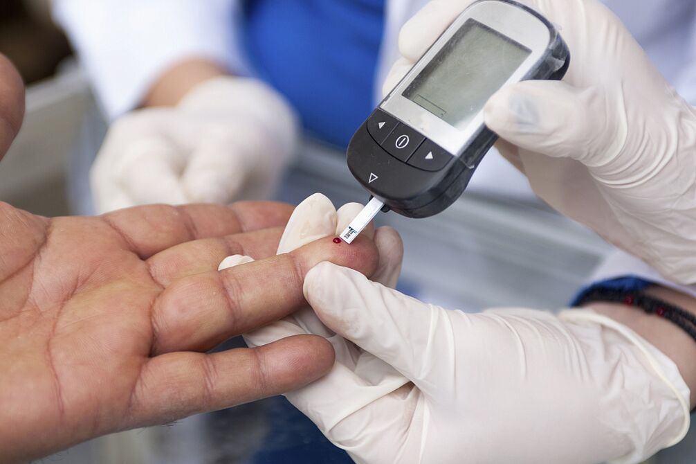 Blood test to determine the fasting plasma glucose concentration to diagnose diabetes